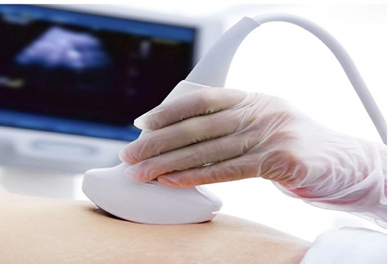 超音波検査サービス画像